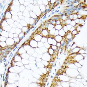 Immunohistochemistry analysis of paraffin-embedded human colon tissue using Anti-ENTPD5 Antibody [ARC2211] (A305942) at a dilution of 1:100 (40X lens). Perform microwave antigen retrieval with 10 mM Tris/EDTA buffer pH 9.0 before commencing with IHC staining protocol