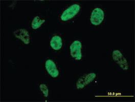 Anti-SP1 Mouse Monoclonal Antibody [clone: 4H6]