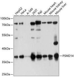 Anti-PSMD14 antibody