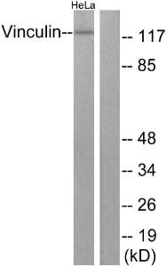 Antibody anti-VINC IN 100 µg