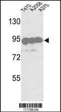 Anti-D19L4 Rabbit Polyclonal Antibody