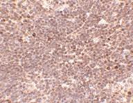 Anti-S1PR1 Rabbit Polyclonal Antibody