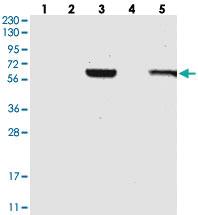 Anti-C1RL Rabbit Polyclonal Antibody