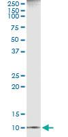 Anti-CXCL11 Antibody Pair