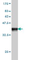 Anti-RAD54B Mouse Monoclonal Antibody [clone: 4A7]