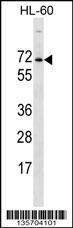 Anti-ACPL2 Rabbit Polyclonal Antibody (AP (Alkaline Phosphatase))