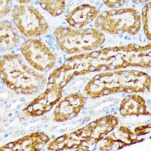 Immunohistochemistry analysis of paraffin-embedded mouse kidney using Anti-ENTPD5 Antibody [ARC2211] (A305942) at a dilution of 1:100 (40X lens). Perform microwave antigen retrieval with 10 mM Tris/EDTA buffer pH 9.0 before commencing with IHC staining protocol