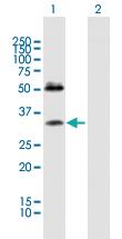 Anti-SDC4 Mouse Polyclonal Antibody