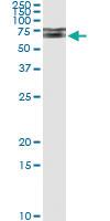 Anti-IRAK1 Antibody Pair