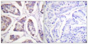 Antibody anti-VINC IN 100 µg