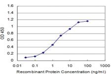 Anti-MAP4K4 Mouse Monoclonal Antibody [clone: 4F8]