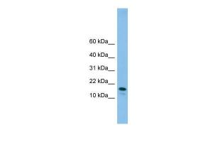 Anti-GREM2 Rabbit Polyclonal Antibody