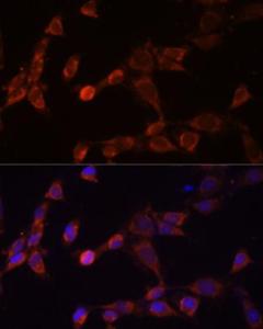 Anti-PSMD14 antibody