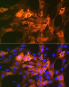 Immunofluorescence analysis of C6 cells using Anti-Alpha B Crystallin Antibody [ARC1672] (A308835) at a dilution of 1:100 (40X lens). DAPI was used to stain the cell nuclei (blue)