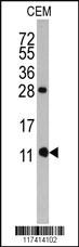 Anti-FKBP1B Rabbit Polyclonal Antibody