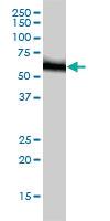 Anti-RNMT Mouse Monoclonal Antibody [clone: 3H3-1D12]