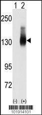 Anti-Jagged2 Rabbit Polyclonal Antibody (PE (Phycoerythrin))