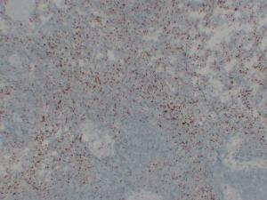 Antibody anti-CD61 ABT-CD61 100 µl