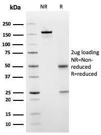 SDS-PAGE analysis of Anti-SERBP1 Antibody [SERBP1/3498] under non-reduced and reduced conditions; showing intact IgG and intact heavy and light chains, respectively. SDS-PAGE analysis confirms the integrity and purity of the antibody