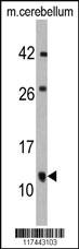 Anti-FKBP1B Rabbit Polyclonal Antibody