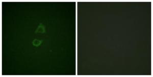 Antibody anti-VINC IN 100 µg