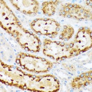 Immunohistochemistry analysis of paraffin-embedded rat kidney using Anti-ENTPD5 Antibody [ARC2211] (A305942) at a dilution of 1:100 (40X lens). Perform microwave antigen retrieval with 10 mM Tris/EDTA buffer pH 9.0 before commencing with IHC staining protocol