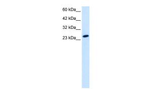 Anti-TBPL1 Rabbit Polyclonal Antibody