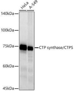 Western blot analysis of extracts of various cell lines, using Anti-CTP synthase / CTPS Antibody [ARC2883] (A308837) at 1:500 dilution. The secondary antibody was Goat Anti-Rabbit IgG H&L Antibody (HRP) at 1:10,000 dilution.