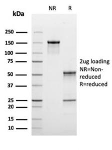 SDS-PAGE analysis of Anti-C1QB Antibody [C1QB/2965] under non-reduced and reduced conditions; showing intact IgG and intact heavy and light chains, respectively. SDS-PAGE analysis confirms the integrity and purity of the antibody.