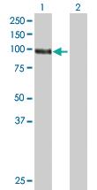 Anti-DGKG Mouse Polyclonal Antibody