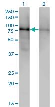 Anti-DBR1 Mouse Monoclonal Antibody [clone: 3A7]