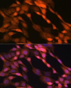 Anti-p23 Rabbit Monoclonal Antibody [clone: ARC1986]