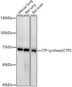 Western blot analysis of extracts of various cell lines, using Anti-CTP synthase / CTPS Antibody [ARC2883] (A308837) at 1:500 dilution. The secondary antibody was Goat Anti-Rabbit IgG H&L Antibody (HRP) at 1:10,000 dilution.