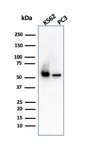 Western blot analysis of K562 and PC3 cell lysates using Anti-SERBP1 Antibody [SERBP1/3498]