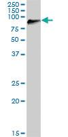 Anti-DGKG Mouse Polyclonal Antibody