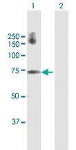 Anti-GALNT6 Rabbit Polyclonal Antibody