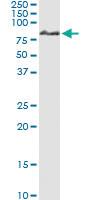 Anti-IRAK1 Polyclonal Antibody Pair