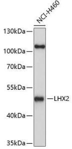 Antibody anti-LHX2 100 µl