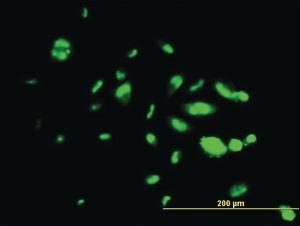 Anti-FOXA1 Mouse Monoclonal Antibody [clone: 1B1]