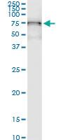 Anti-GALNT6 Rabbit Polyclonal Antibody