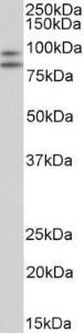 Anti-CD34 Antibody (A82559) (2 µg/ml) staining of Peripheral Blood Lymphocytes lysate (35 µg protein in RIPA buffer). Primary incubation was 1 hour. Detected by chemilu minescence