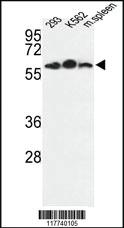 Anti-ESRRG Rabbit Polyclonal Antibody