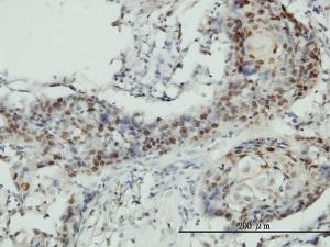 Anti-RNMT Mouse Monoclonal Antibody [clone: 3H3-1D12]