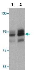 Anti-ZEB2 Rabbit Polyclonal Antibody