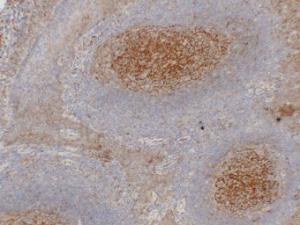 Immunohistochemical analysis of paraffin-embedded human Tonsil using Anti-CD54 Antibody