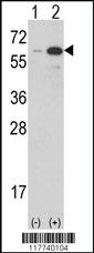 Anti-ESRRG Rabbit Polyclonal Antibody