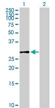 Anti-DHDDS Mouse Polyclonal Antibody