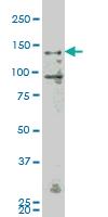 Anti-MAP4K4 Mouse Monoclonal Antibody [clone: 4A5]