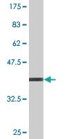 Anti-PIPOX Mouse Monoclonal Antibody [clone: 3D1]