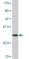 Anti-IKZF5 Mouse Monoclonal Antibody [clone: 1B6]